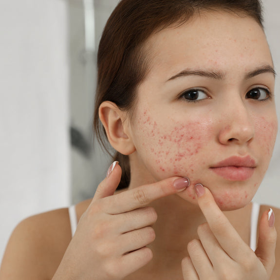 AYUMI Neem and Tea Tree Face Wash 150ml | Pimple | Acne Skin