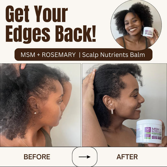 Qhemet Biologics MSM + Rosemary Scalp Nutrients Balm