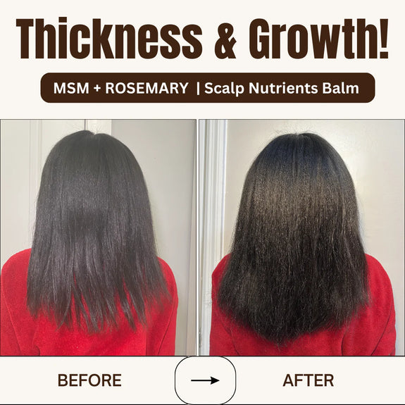 Qhemet Biologics MSM + Rosemary Scalp Nutrients Balm