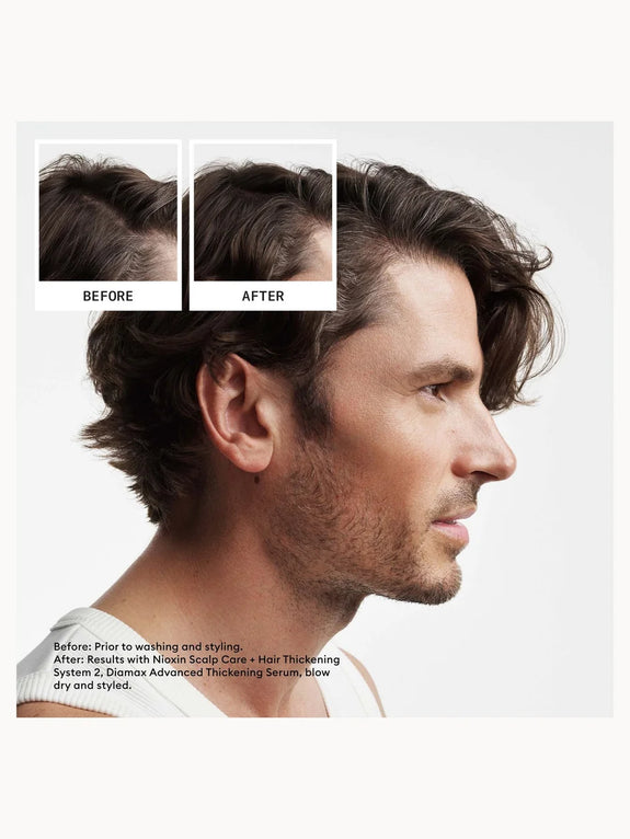Nioxin System 2 Trial Kit for Natural Hair Thinning