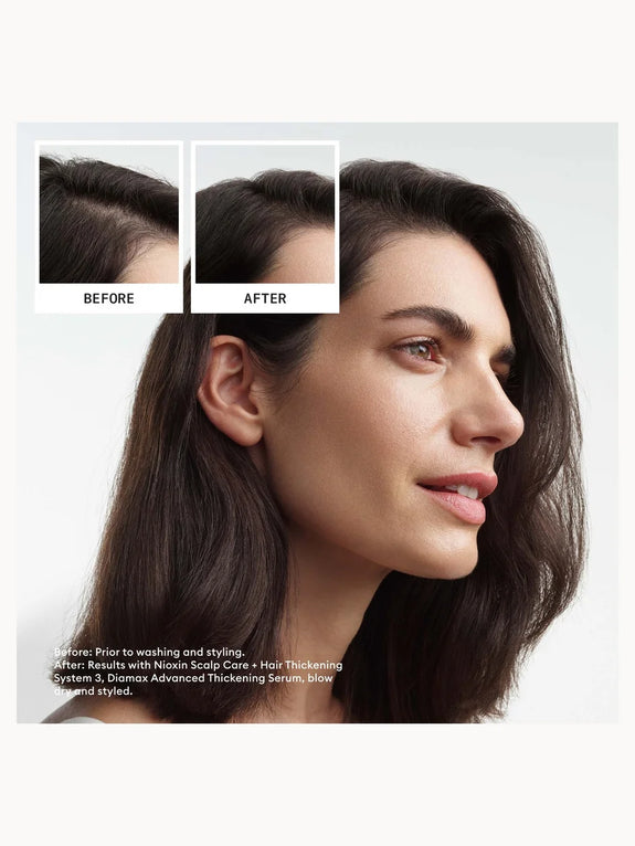 Nioxin System 3 Trial Kit for Coloured Thinning Hair