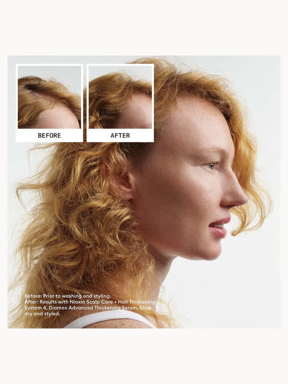 Nioxin System 4 Loyalty Kit for Coloured Thinning Hair