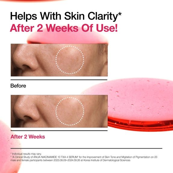 ANUA NIACINAMIDE 10%+TXA 4% Serum
